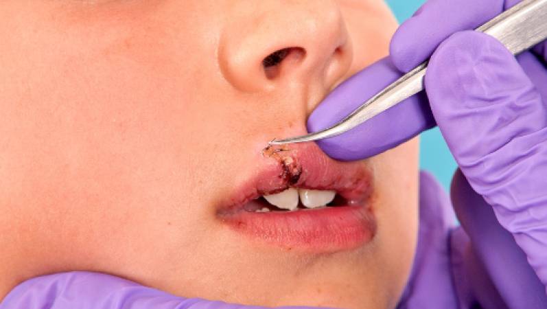 Evde Dikiş Alma ve Atma